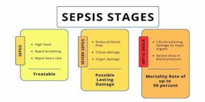 nursing home sepsis stages, attorney Brian Murphy, Philadelphia, New Jersey, medical malpractice, bed sores, wrongful death lawsuits