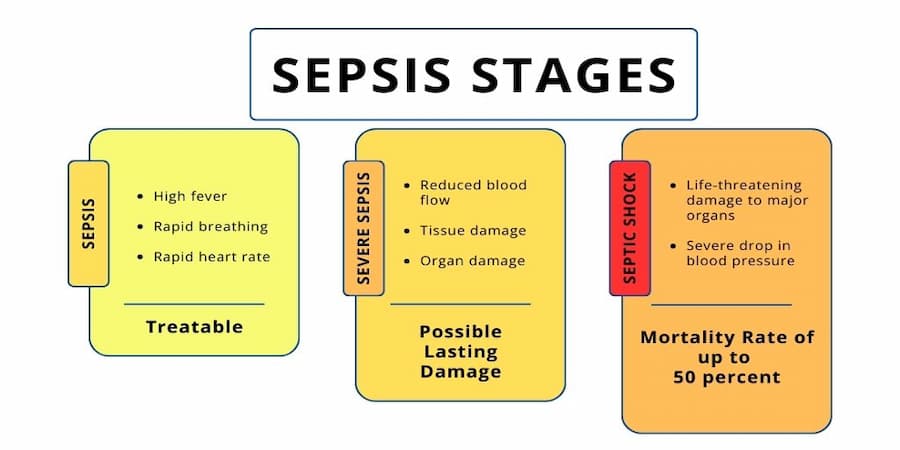 nursing home sepsis stages, attorney Brian Murphy, Philadelphia, New Jersey, medical malpractice, bed sores, wrongful death lawsuits